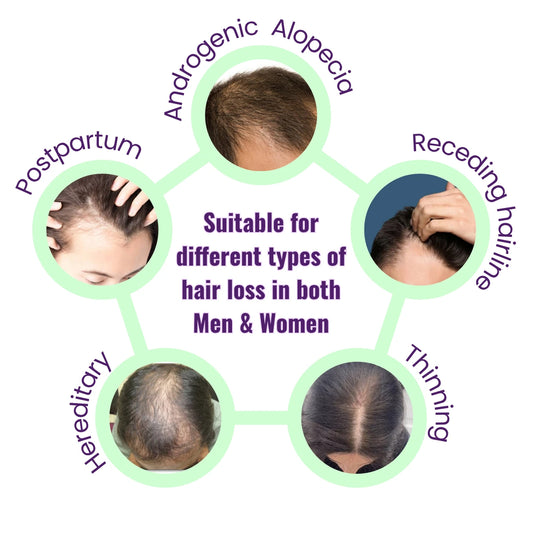 Diagram showing different types of hair loss with images and text labels.