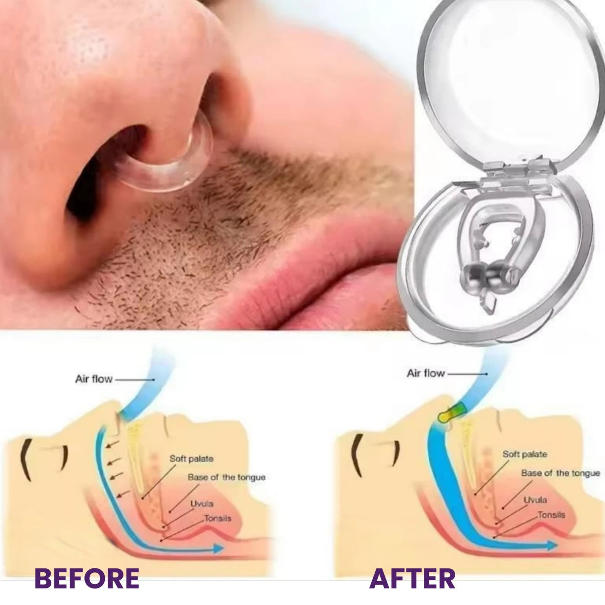 SilentMag™ Anti-Snore Aid