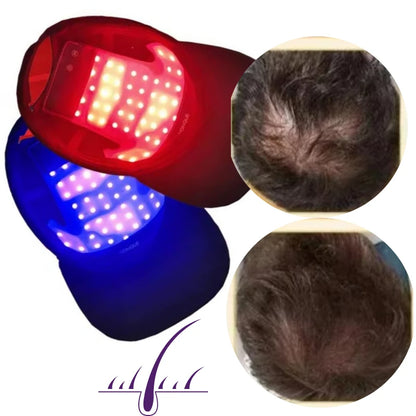 Red Light Hair Growth Therapy