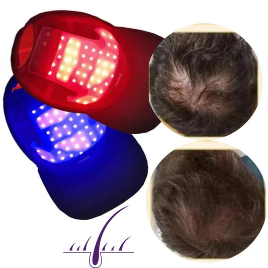Red Light Hair Growth Therapy